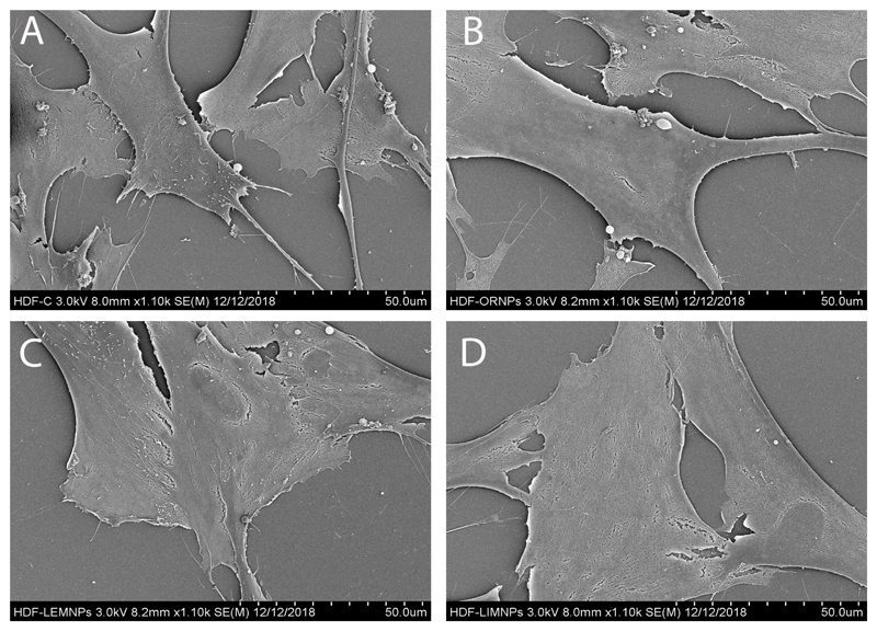 Figure 11