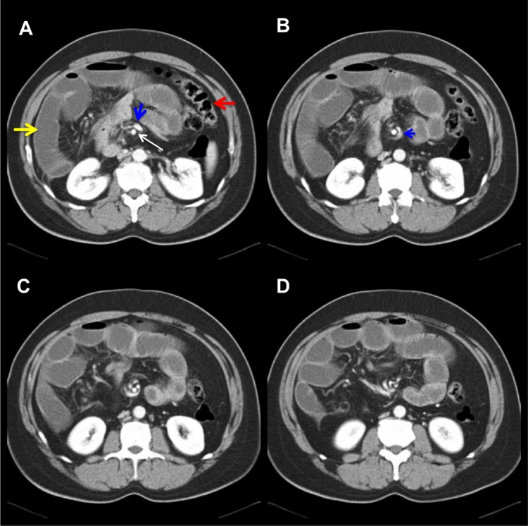 Figure 2