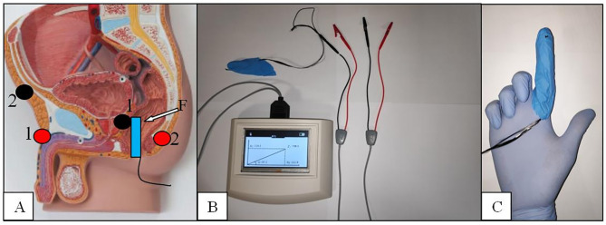 Figure 2