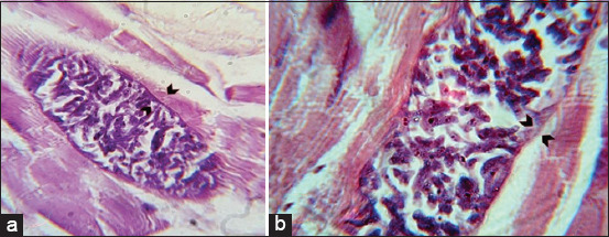 Figure-5