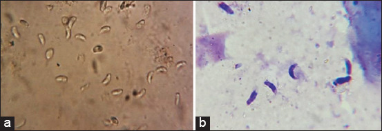 Figure-1