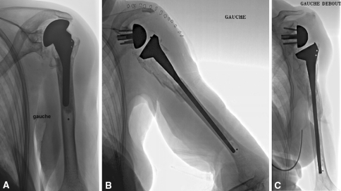 Fig. 7A–C