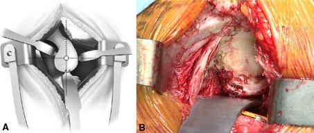 Fig. 3A–B