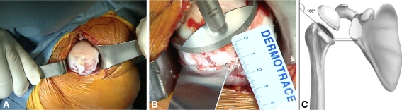 Fig. 2A–C