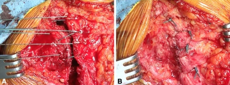 Fig. 5A–B