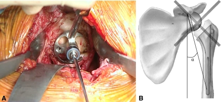 Fig. 4A–B