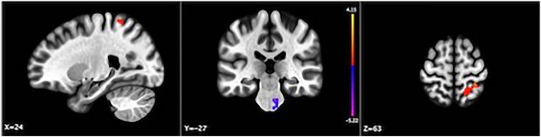 Fig. 3