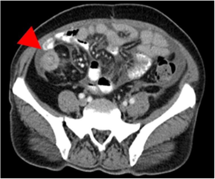 Fig. 1