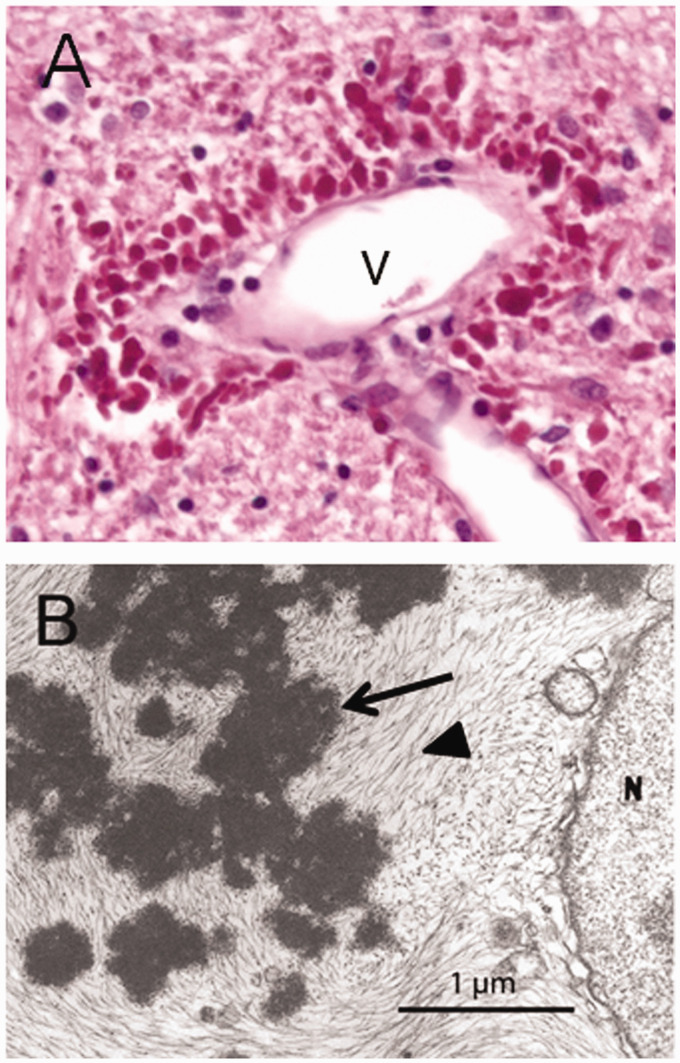 Figure 11.