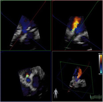 Fig. 15