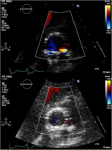 Fig. 3