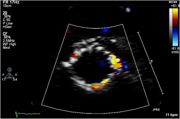 Fig. 1