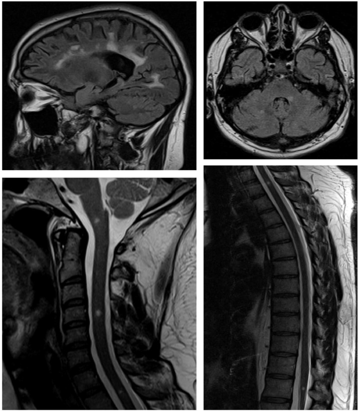 Fig. 1