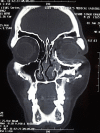 Fig. 14