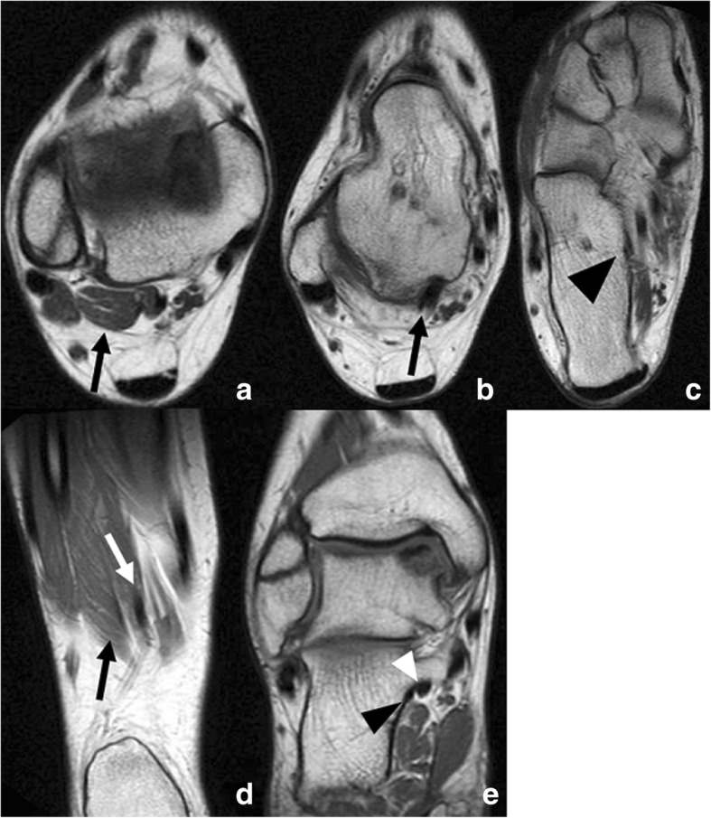 Fig. 12