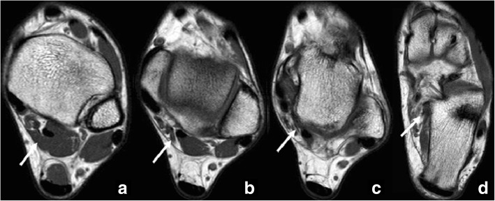 Fig. 11