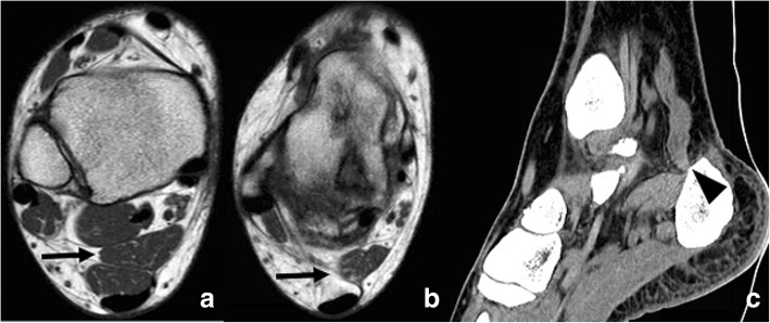 Fig. 13