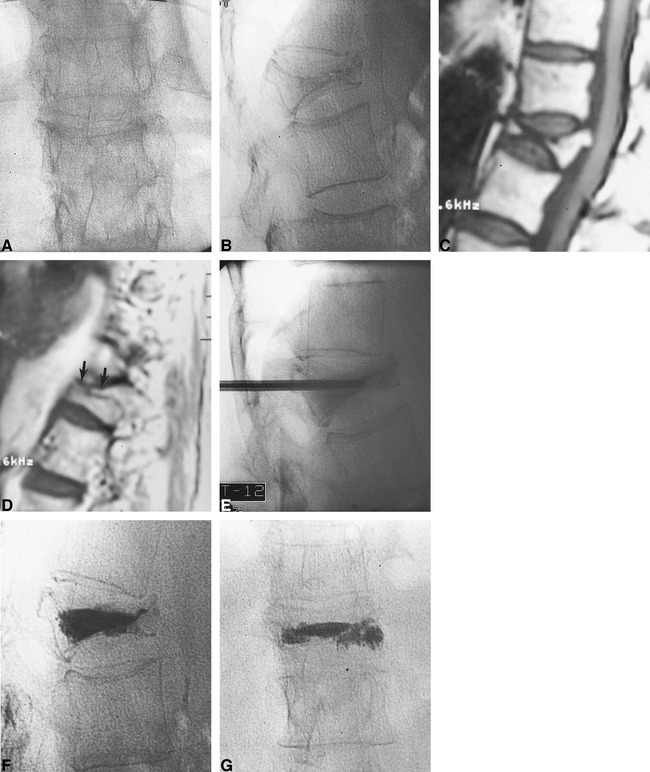 fig 2.