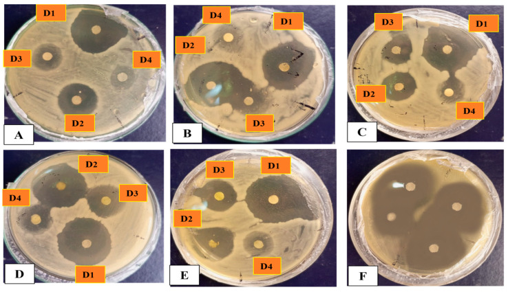 Figure 11