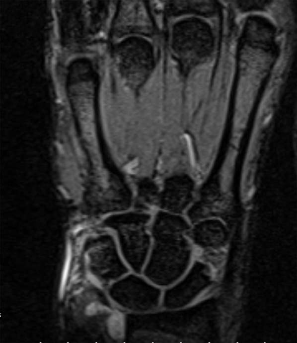 Figure 13.