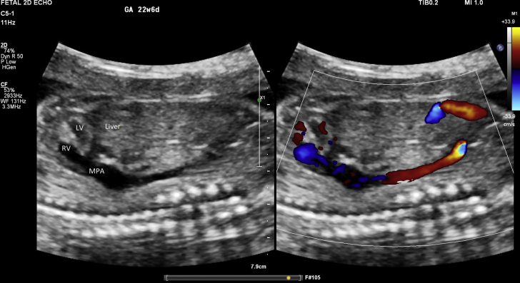 Figure 3