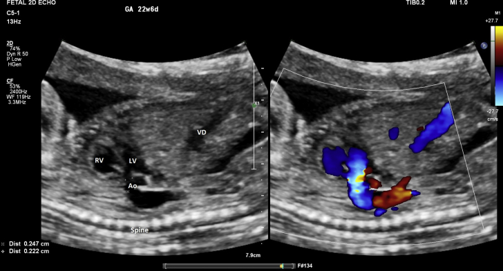 Figure 4