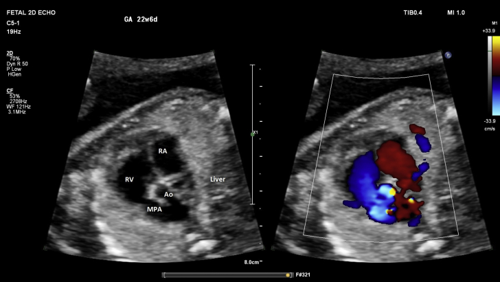 Figure 2