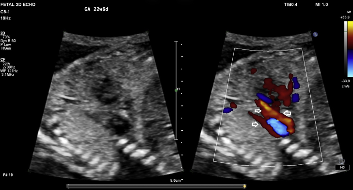 Figure 5