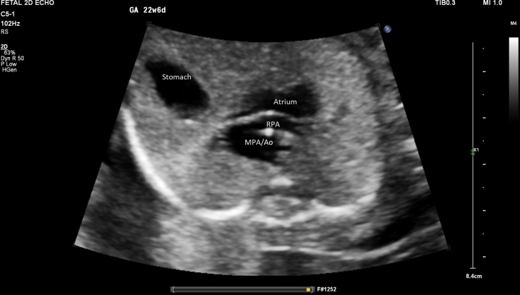 Figure 6
