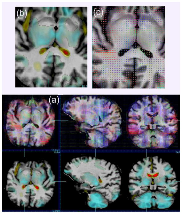 Fig. 3