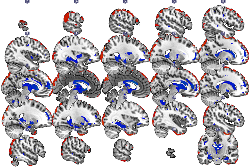 Figure 1a: