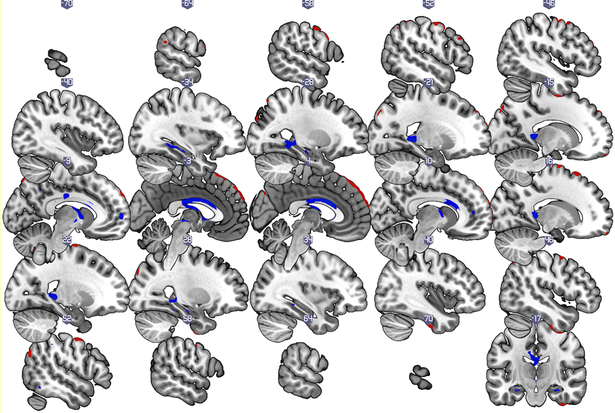 Figure 1b: