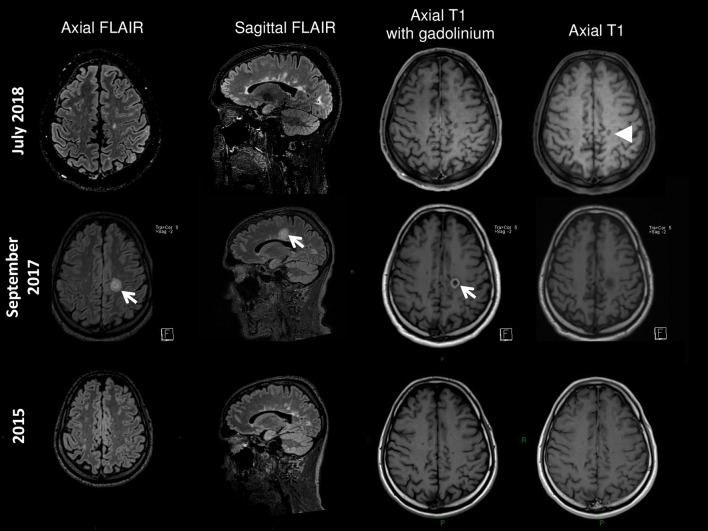 Fig. 1