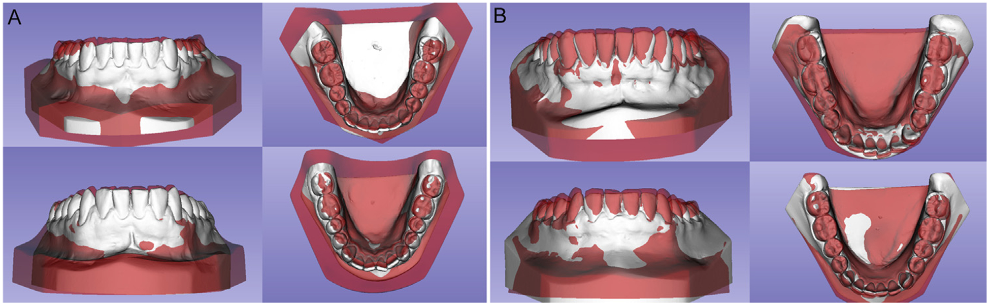 Fig 4.