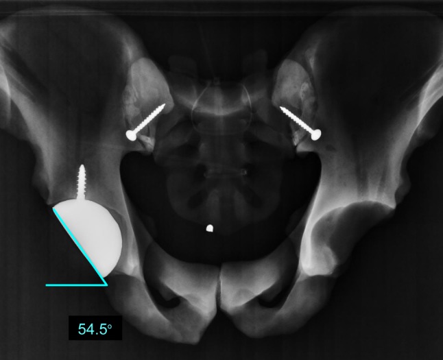 Fig. 3