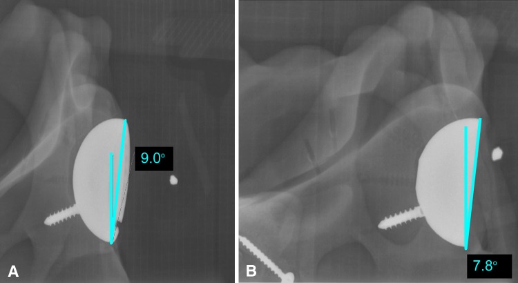 Fig. 1A–B