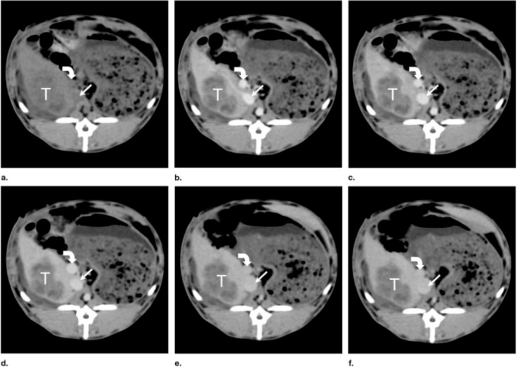 Figure 15