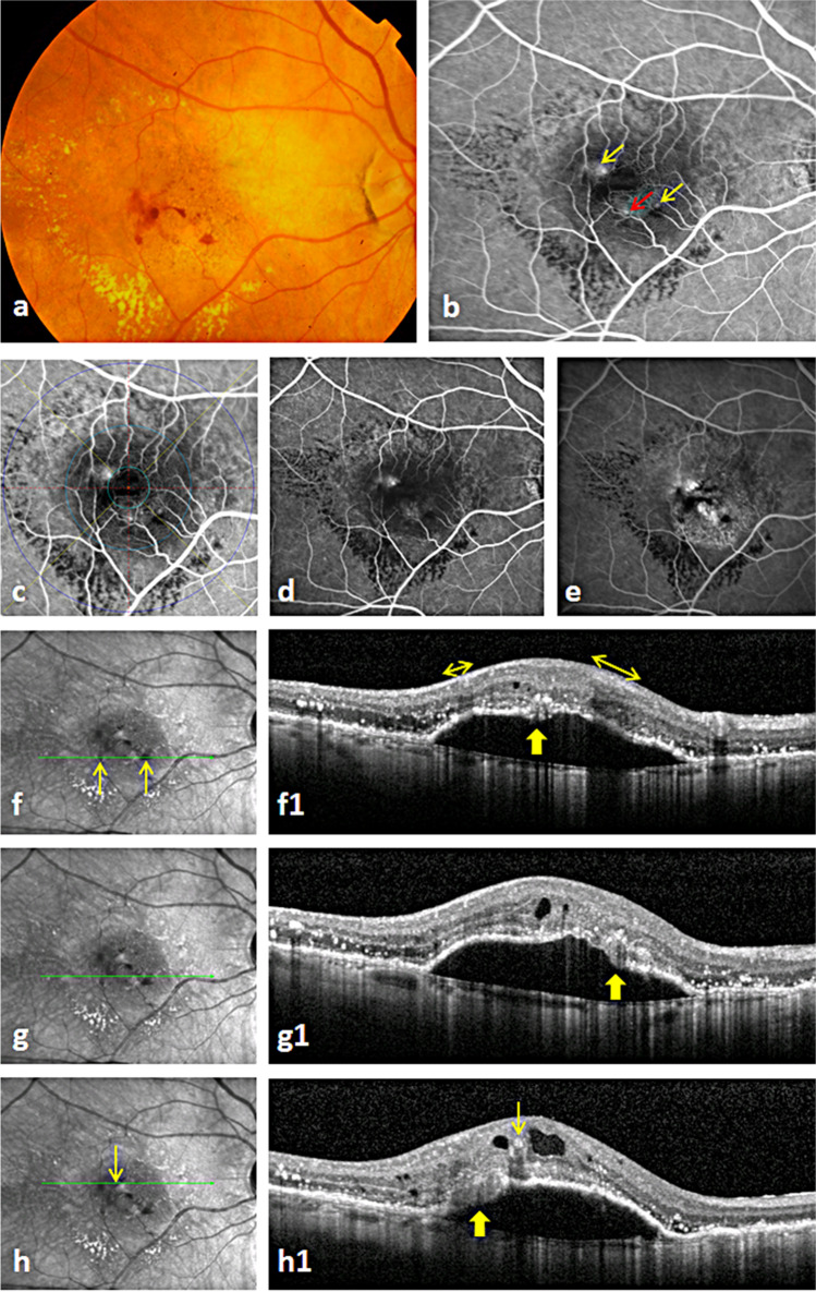 Fig. 2