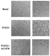 FIG. 11