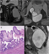 Fig. 11