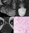 Fig. 10