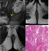 Fig. 12