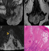 Fig. 13