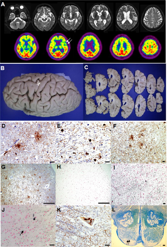 Fig.1