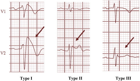 Fig. 6