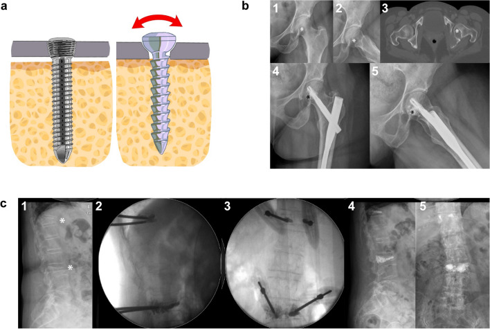 Fig. 3