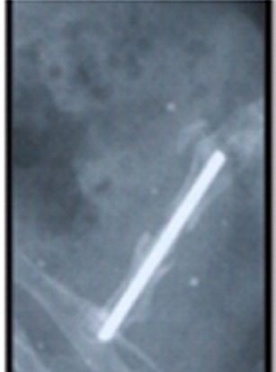 
Fig. 4a
