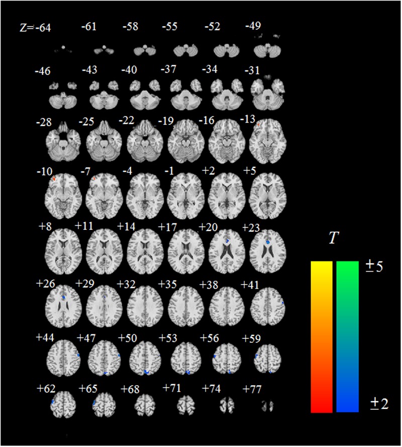 FIGURE 3