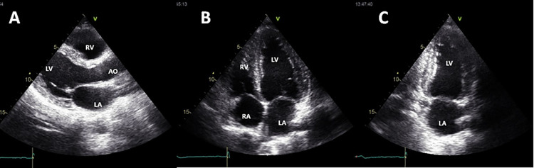 Fig 1