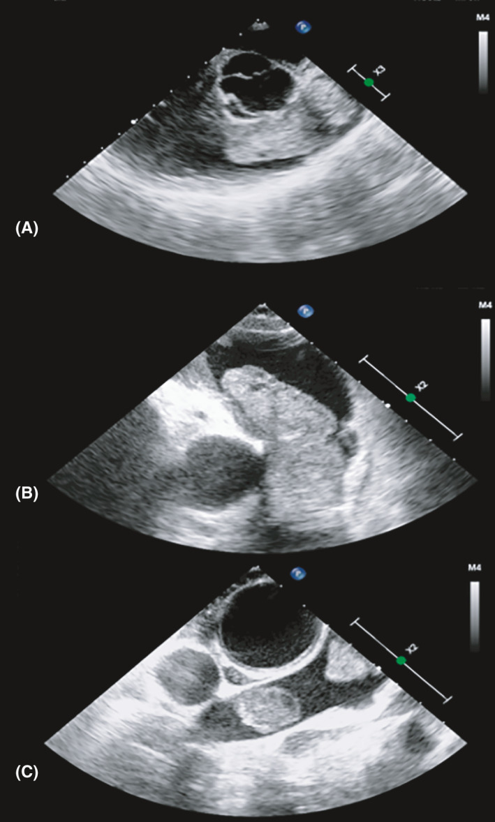 FIGURE 4